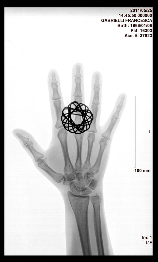 Francesca Gabrielli - Chernobyil 1986 - Fukushima 2011 - X-ray - ring - 2011 .jpg