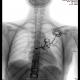 Francesca Gabrielli - Chernobyil 1986 - Fukushima 2011 - X-ray - brooche - 2011 .jpg